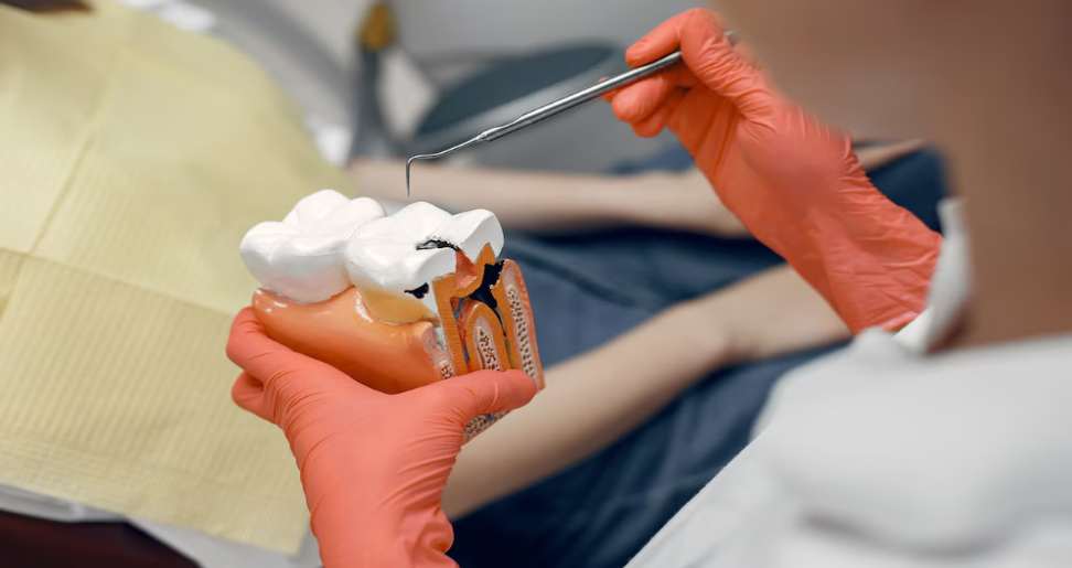 Root Canal Treatment Cost in Kolkata: Everything You Need to Know